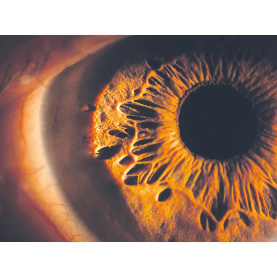 300-990 | RSL 5000 Slit Lamp Haag-Streit Type