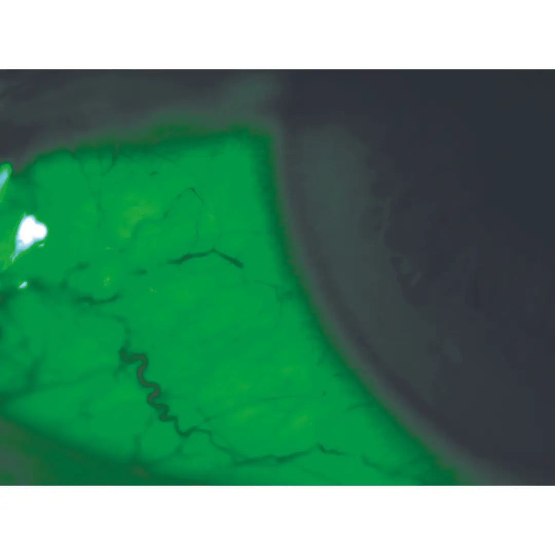 300-990 | RSL 5000 Slit Lamp Haag-Streit Type