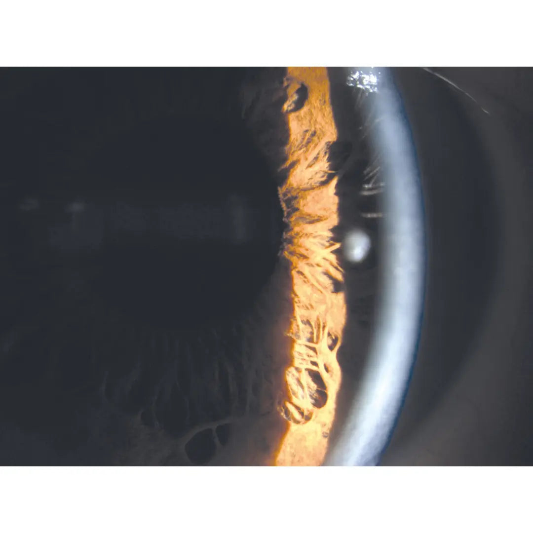 300-990 | RSL 5000 Slit Lamp Haag-Streit Type