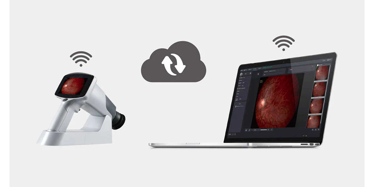 INS-11105 | Hand-held Fundus Camera